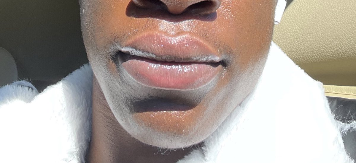HunchoDatNigga_'s tweet photo. 👄 https://t.co/j0lOKw4V6L