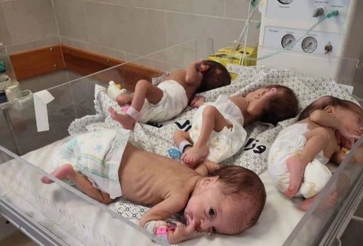 Gaza doesn’t have enough food for the children, while the world full of food is watching and doing nothing. Forced starvation in Gaza is an act of genocide.
