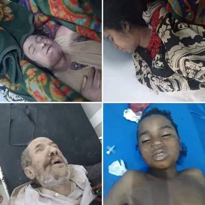 الصوره من رداع وليست من غ*زه

هذا ماحصل اليوم في جريمه الأولى من نوعها في اليمن