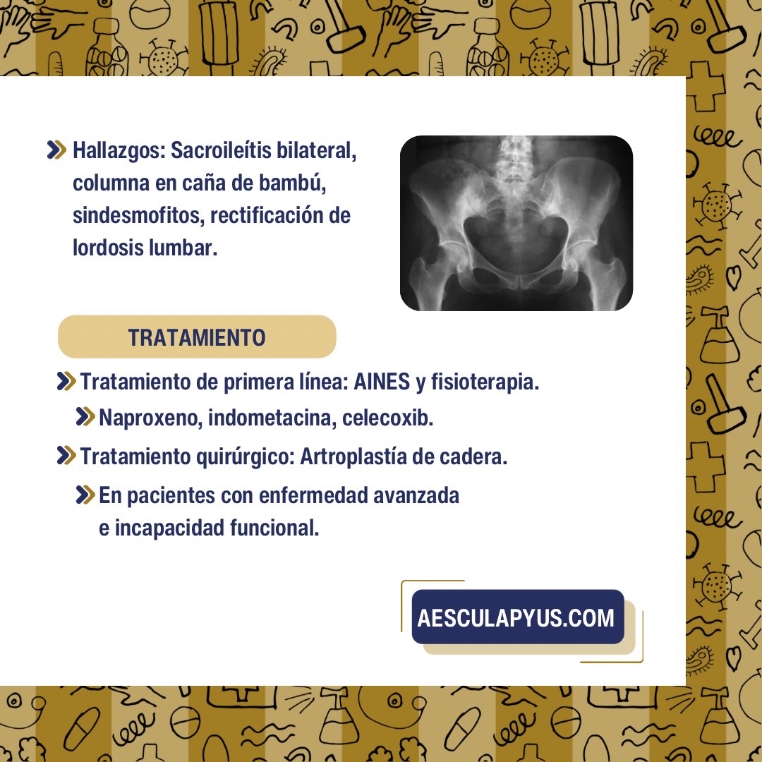 Aesculapyus_MD's tweet photo. Repasa Espondilitis anquilosante con Aesculapyus #ENARM2024 #MIR https://t.co/zc02D2yynN