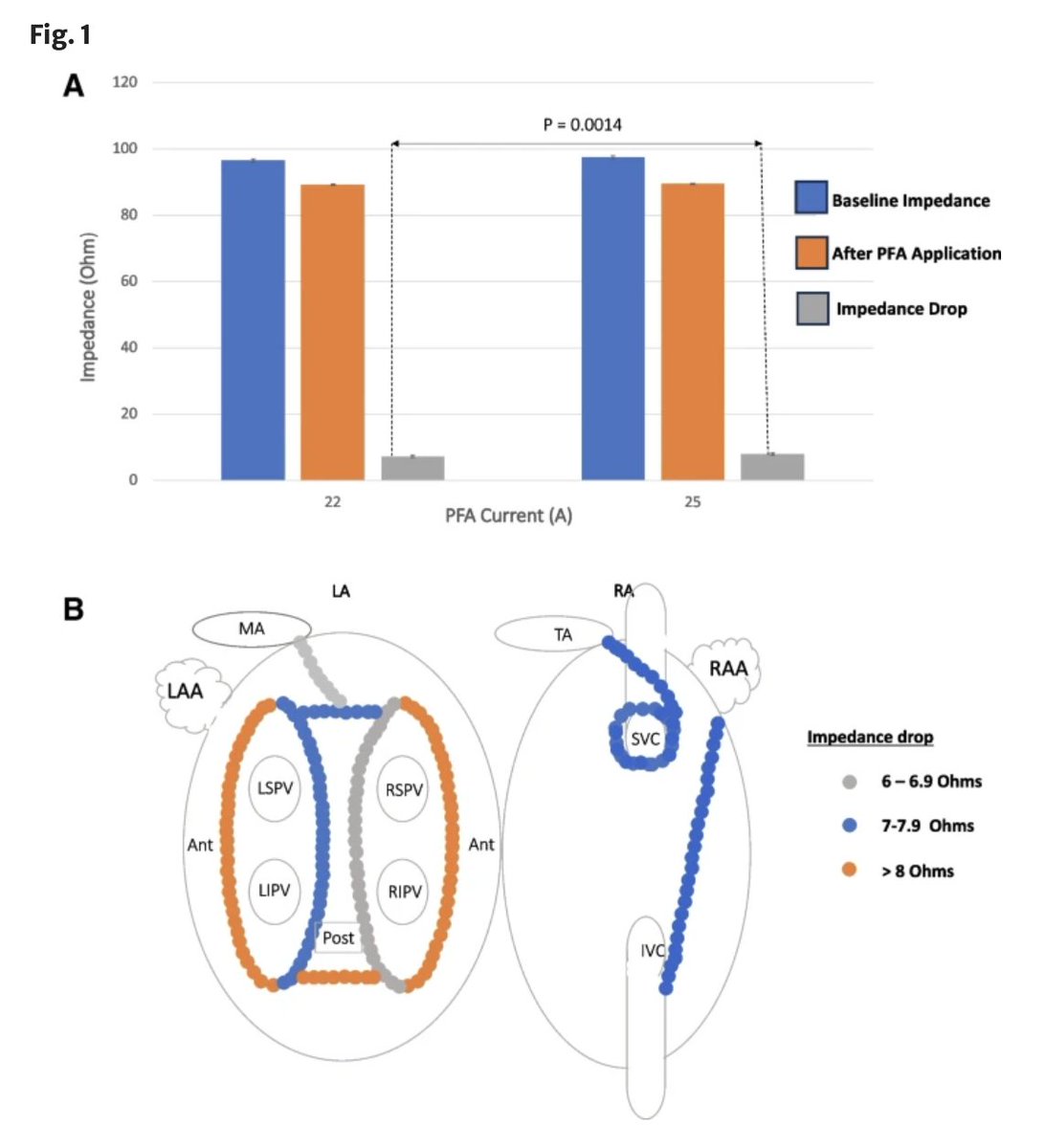 🚨New #FreeRead Article in @JICE_EP Impedance Drop during Focal Monopolar Pulsed Field Ablation in the Atrium 📖🧐 rdcu.be/dBPjw by @Farnir_Florent, @JLuermans, Frédéric P. F. J. D. J. Farnir, Sevasti-Maria Chaldoupi & @Dominik_Linz #EPeeps