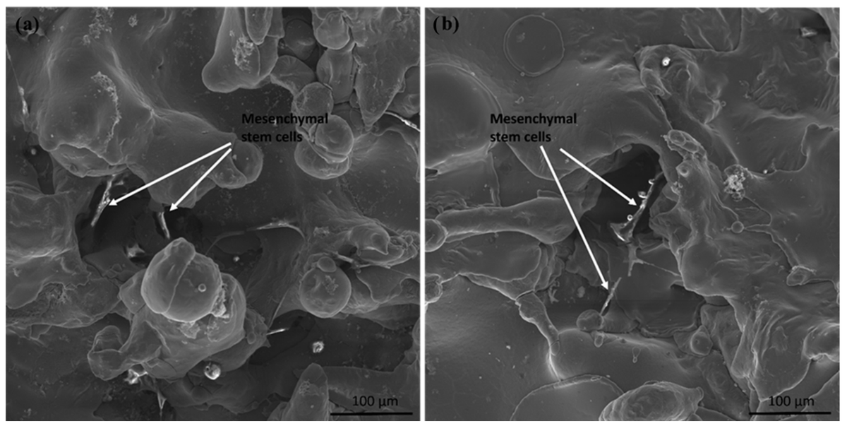 Coatings_MDPI's tweet photo. 📰 Biocompatibility and Corrosion of Microplasma-Sprayed Titanium and Tantalum Coatings versus Titanium Alloy

👉 https://t.co/8rKydrFm34

🍒 #biocompatible #coatings; in vitro test; #corrosion resistance; #microplasma #spraying (MPS); medical #implants; #coating #techniques https://t.co/DTZ4z6vEZT
