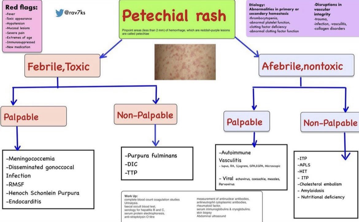 Differential Diagnosis of Petechial Rash 👶🏽👶🏼 #FOAMed #PEM #MedEd #MedTwitter #Emergency #FOAped #residents #Students #medicaleducation #medicalstudent #pediamed #NICU #PICU #pediatwitter #pediatricians #child #rash #skin #dermatology