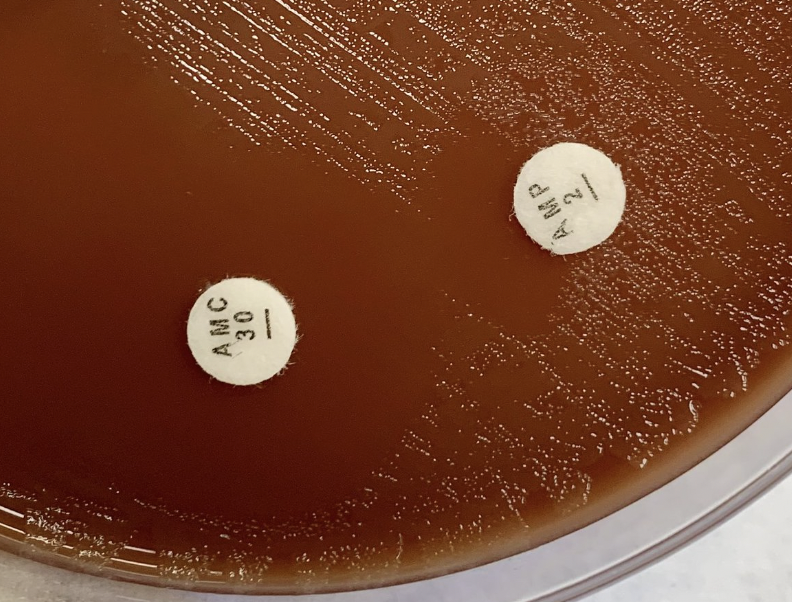 MICROBIOLOGÍA - Hospital Clínico de Valencia tweet media