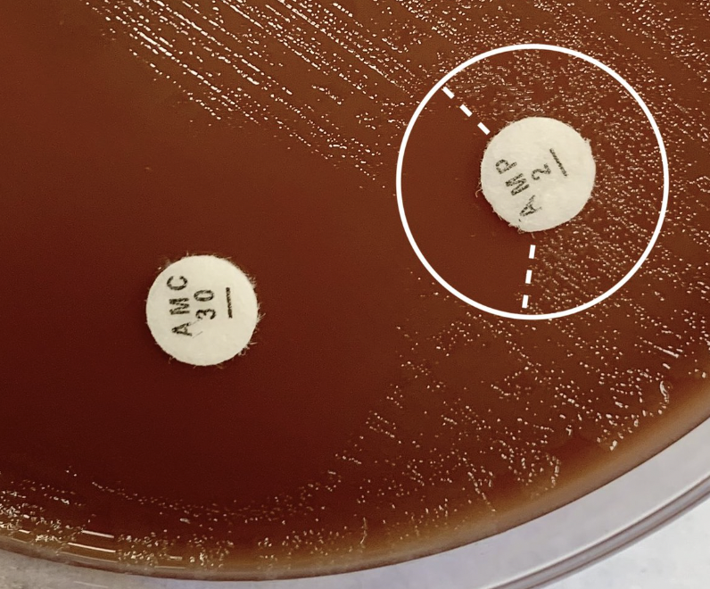 MICROBIOLOGÍA - Hospital Clínico de Valencia tweet media