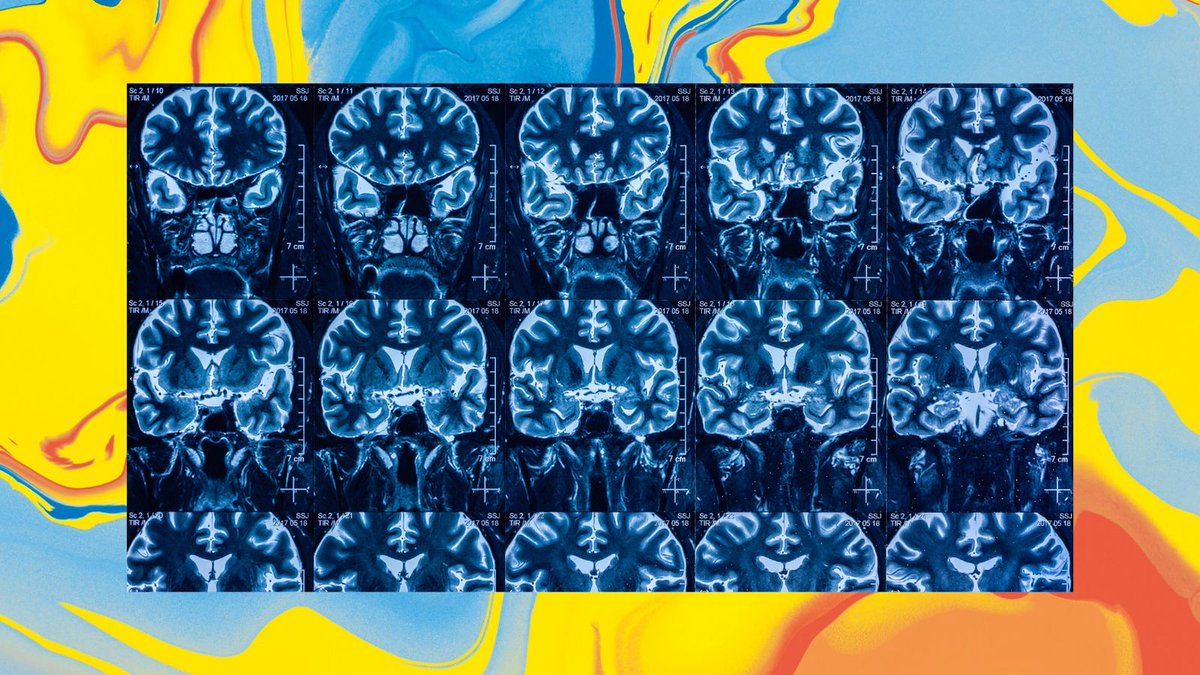 Heute ab 19:30 Uhr starten wir mit „Diagnostische Radiologie: Kopf & Körper“. Am Donnerstag dann: Kopf-Hals-Radiologie. #Neuroradiologie und #Interdisziplinarität stehen am Samstag im Fokus. roentgenkongress.de/roeko-digital/… #RÖKO2024 #Radiologie #Fortbildung #MTR