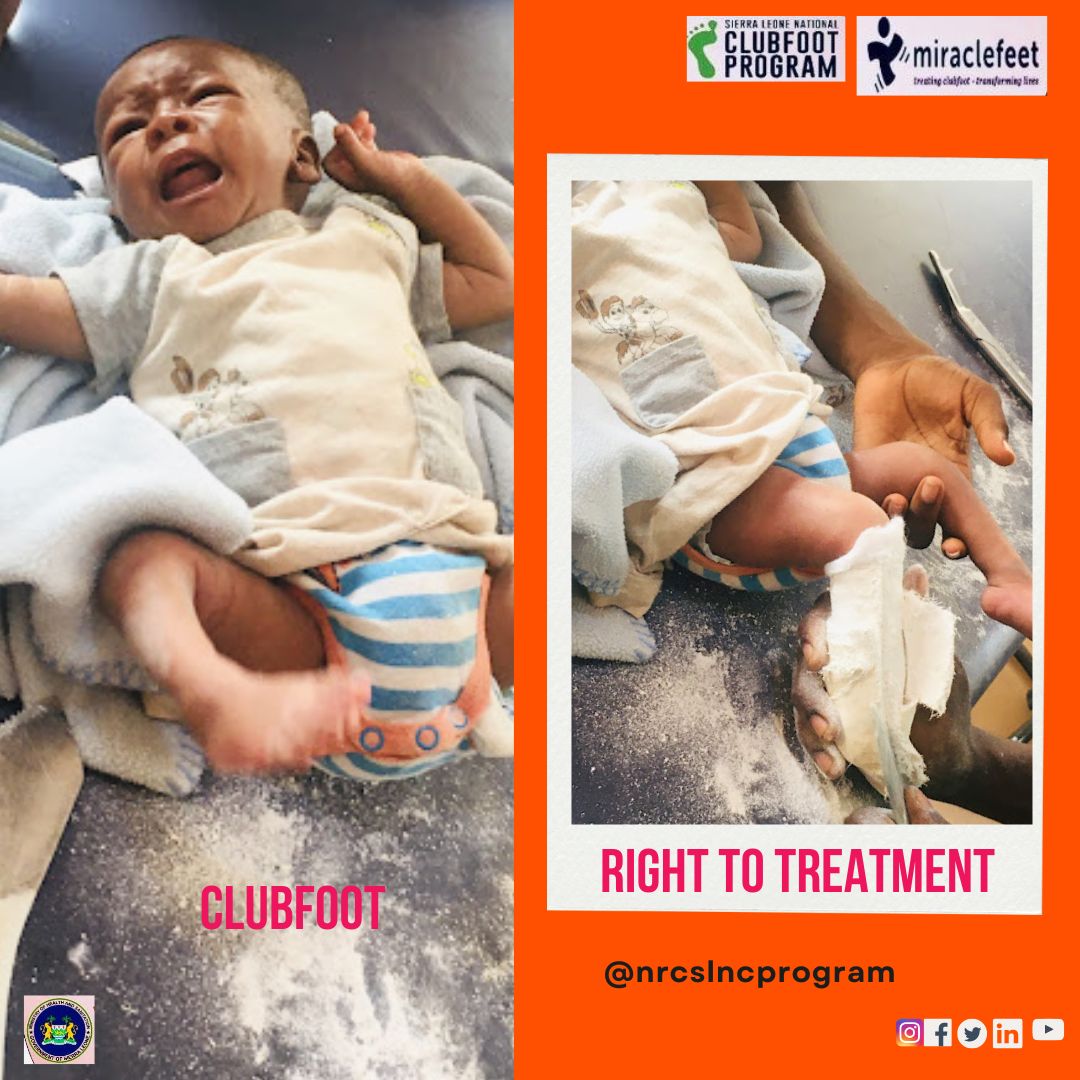 'Backed by statistical evidence showcasing improved outcomes, it's imperative to advocate for the inherent right and universal access to treatment for every child born with clubfoot.'