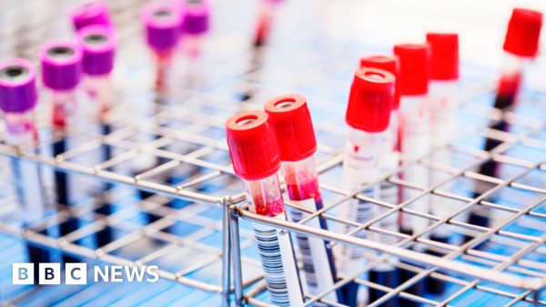 Scientists say they can cut HIV out of cells
#Crispr #geneediting  #rowlandtalent tinyurl.com/yn6abmr6