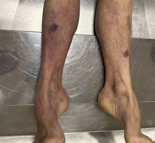 [AHORA EN ABIERTO]

Investigan la muerte de un hombre de 36 años que estaba en manos de los Bizkor de la Ertzaintza

naiz.eus/es/info/notici…

Estos son las imágenes, la autopsia y las iniciativas para esclarecerlo