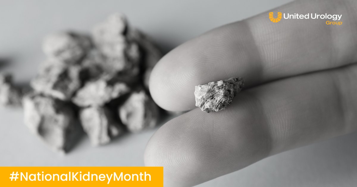 Kidney stones can be a pain, literally. They're also common. Approximately one in 10 people will suffer from kidney stones in their lifetime. Fortunately treatments are available, and there are steps one can take to keep stones from recurring. Learn more. unitedurology.com/conditions-tre…