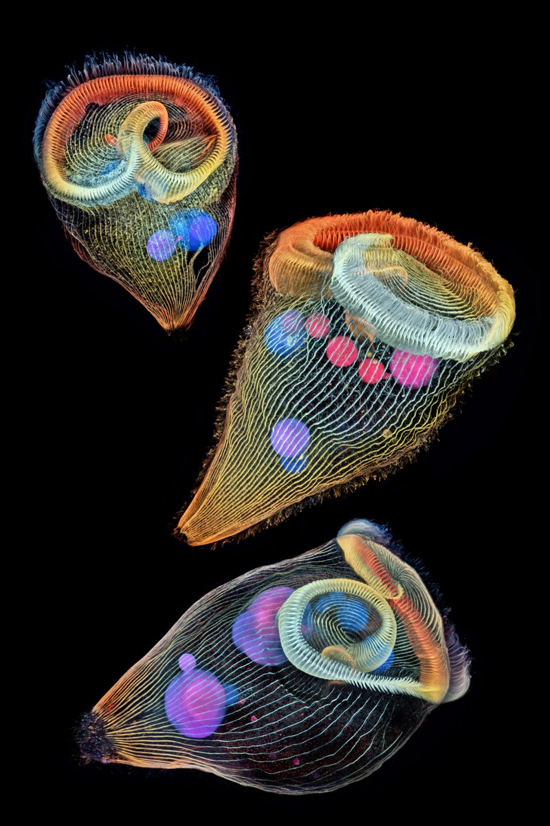 Confocal microscopy was used to capture the detail of the cilia – tiny hairs used by the animals for feeding and locomotion – on these single-cell freshwater protozoans. #WednesdayWisdom bit.ly/49cF1kl Credit: Dr. Igor Siwanowicz