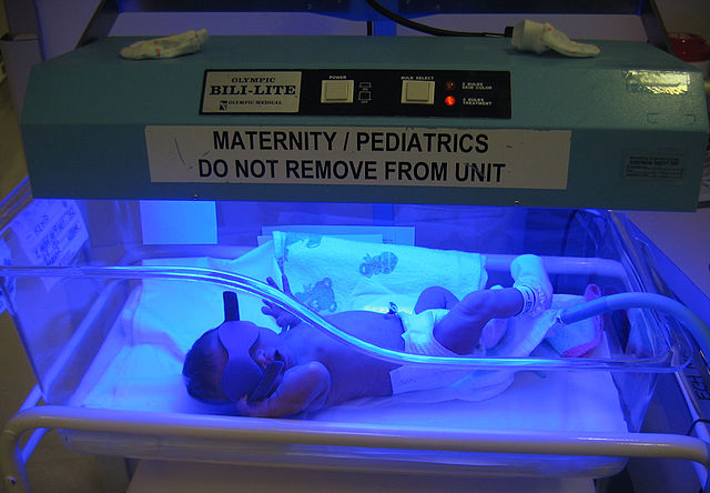 NICU_Musings's tweet photo. Impact of 2022 @AmerAcadPeds new #hyperbilirubinemia guidelines
>22 000 newborns
✅47% ⬇️ in phototherapy - 3.9% to 2.1% (P < .001) ✅TSB measurements ⬇️ 23%, from 712 to 551 per 1000 newborns (P < .001)
✅no ⬆️ in outpatient TSB measurements
https://t.co/SDbE9w2G3M
#neoTwitter https://t.co/6EeSBkgsiY
