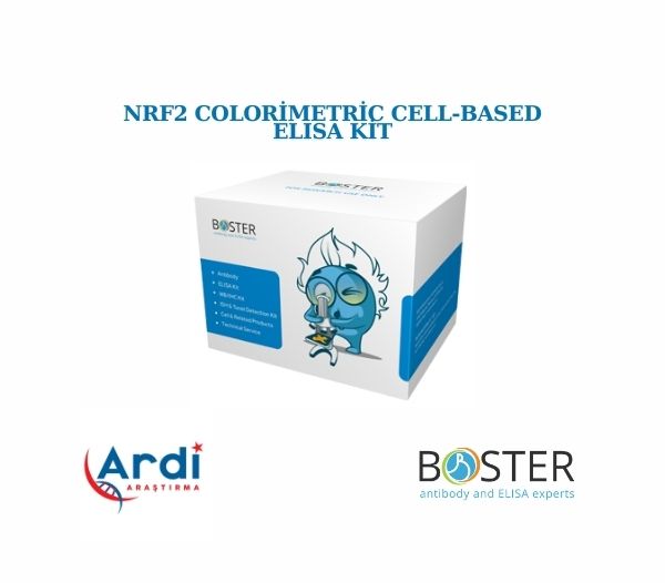 Nrf2 Colorimetric Cell-Based ELISA Kit🚀

⚡SKU:EKC1408
⚡Boyut: Bir adet 96 kuyulu plaka ve gerekli tüm reaktifleri içermektedir
⚡Reaktif Türler: İnsan, Fare, Sıçan
⚡Uygulama: ELISA