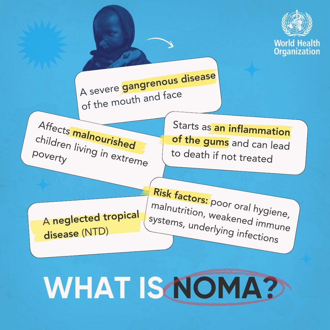 Have you heard about #noma❓ Officially recognized as a neglected tropical disease (NTD) in December 2023, noma is an oral disease affecting children aged 2 to 6 years old in poor communities. Early detection is crucial, as the disease rapidly destroys facial tissues & bones.