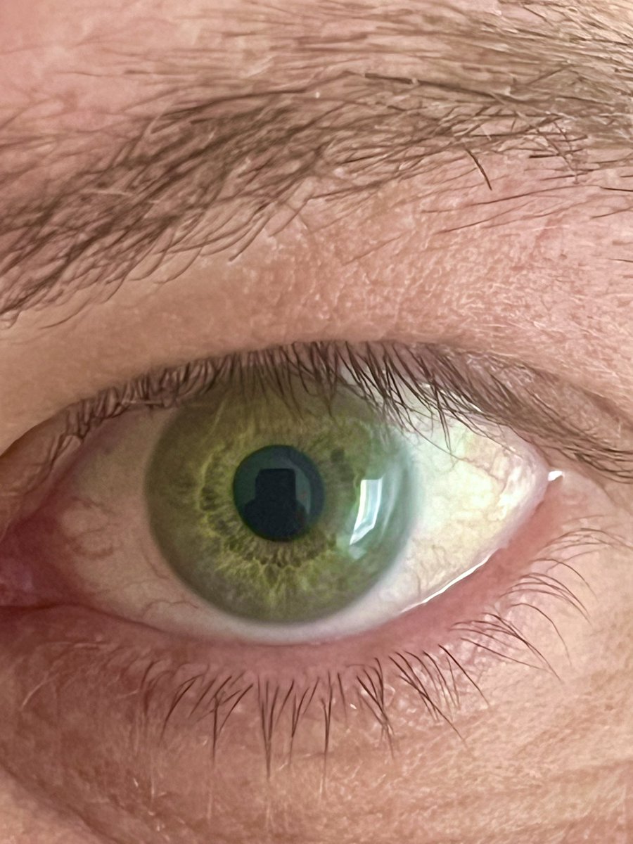 Keine Ahnung wie der Hashtag hieß! #eyeposting