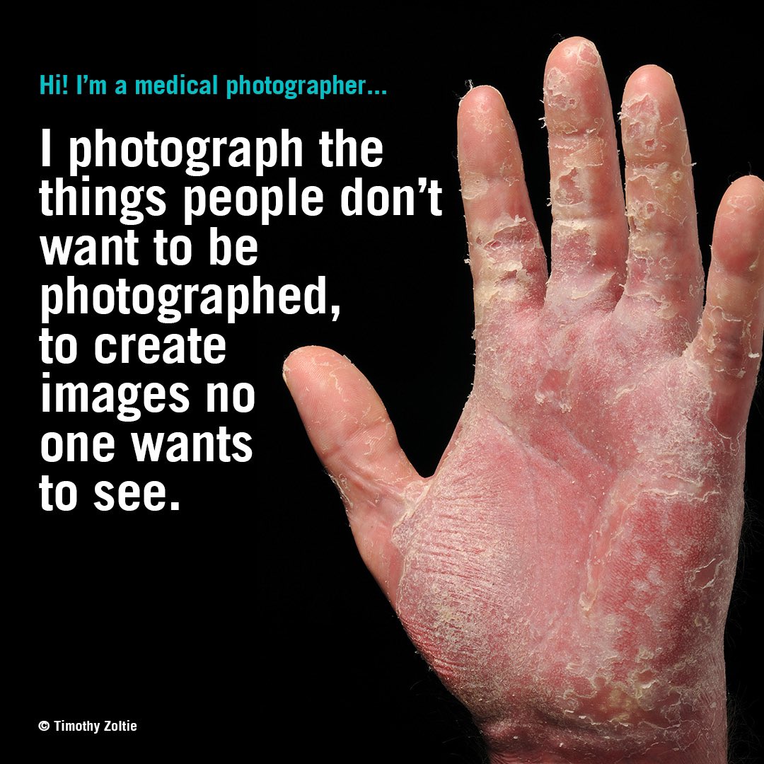 Every wondered what a medical photographer does? …

@imi_org 
#lifeasamedicalphotographer #medicalphotography #medicalphotography #dentalphotographer #photographer #photooftheday #dermatitis
