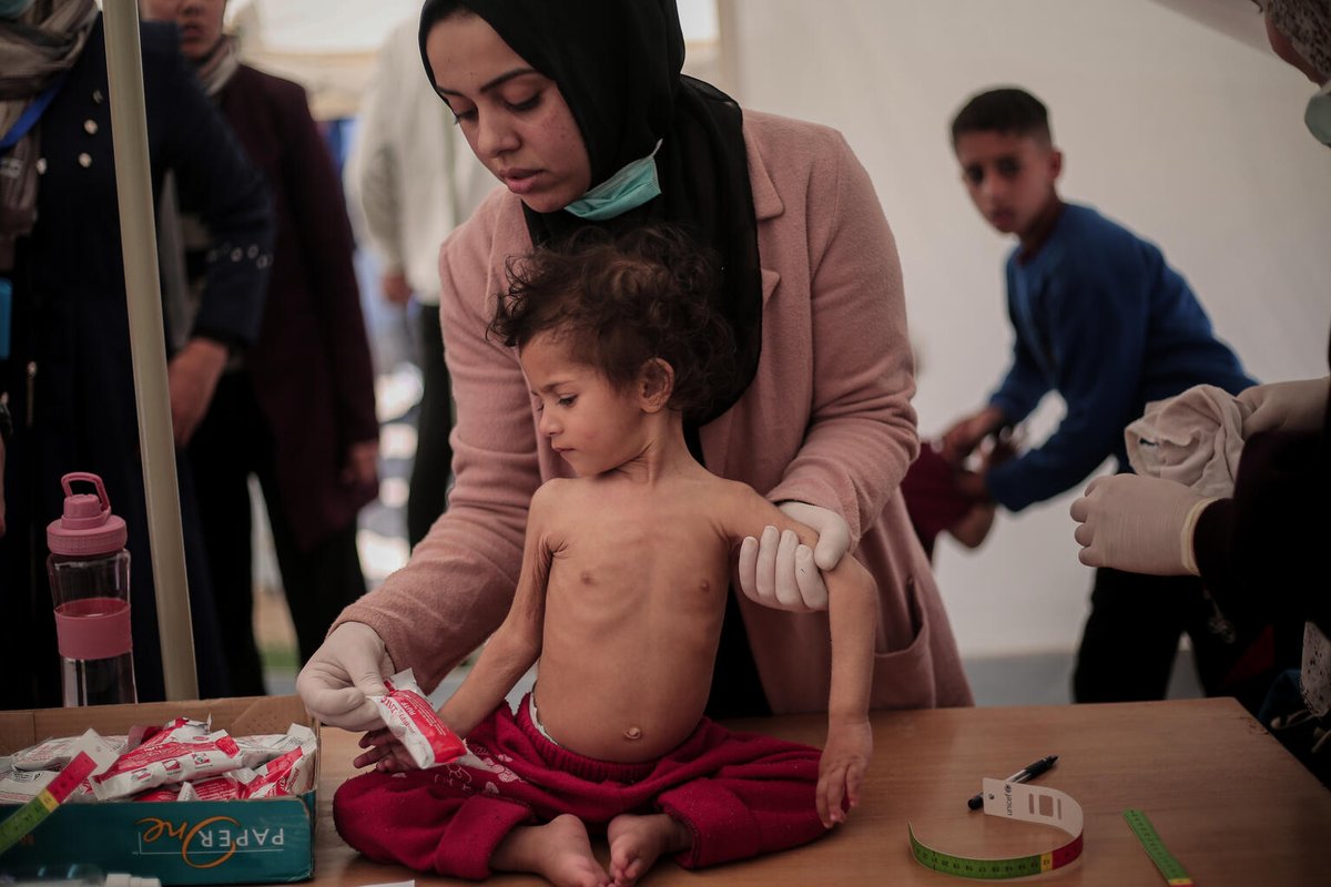 🔴 UNICEF slaat alarm: kinderen in #Gaza sterven aan ondervoeding en uitdroging.

UNICEF voorziet hen in de mate van het mogelijke van levensreddende noodhulpgoederen, zoals kant-en-klare therapeutische voeding. 

#VoorIederKind