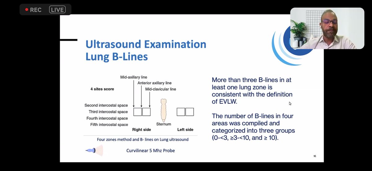 3/ POCUS training in Iraq - focusing on dry weight measurement @alanephro Considering the promising outcomes from the initial experience in Iraq, would you consider adopting and implementing it? #ThisIsIsn #ISNwebinar