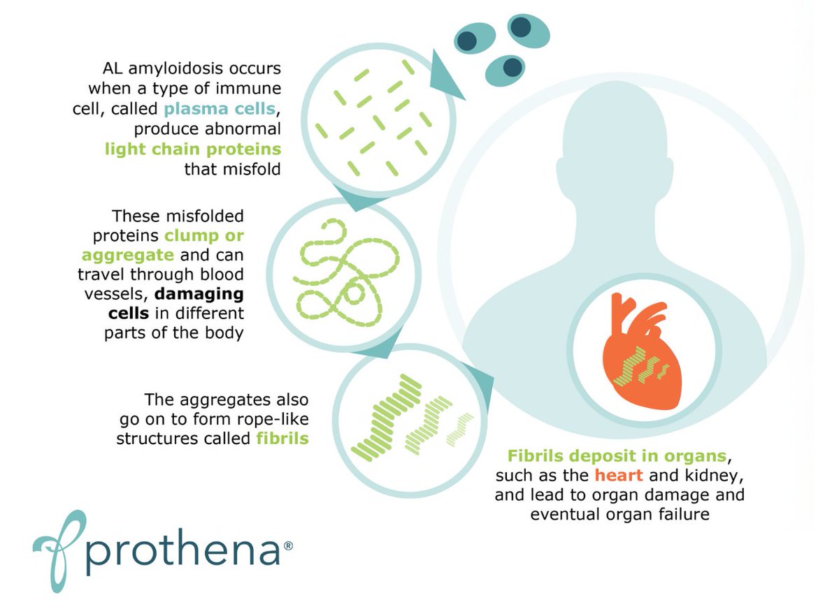 There is an urgent unmet need for therapies that address both the amyloid circulating and deposited in vital organs for those living with AL #amyloidosis. Learn more about our work in this area by visiting our pipeline: bit.ly/3x06KXT #AmyloidosisAwarenessMonth