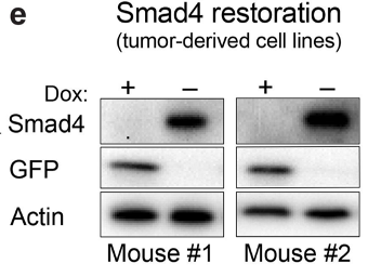 ktsanov's tweet photo. A paradigm of such mutations is #SMAD4 inactivation, a hallmark of multiple GI malignancies w/ highest frequency in #PDAC. To determine if met tumors remain dependent on SMAD4 inactivation, we developed a new mouse model of met PDAC that enables reversible SMAD4 depletion. 3/n https://t.co/bdin9YrtxQ