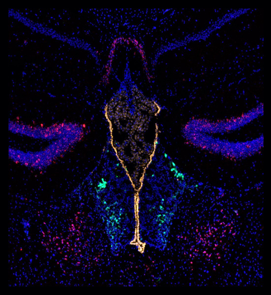 Friedman Brain Institute (@sinaibrain) on Twitter photo Dr <a href="/Mr_Beto_Corona/">Alberto Corona</a>'s STUNNING "Habenular metamorphosis" showcases the beauty & the complexity of the brain! Learn More about this work at the Art of the Brain virtual exhibition 👉 shorturl.at/fELRX VOTE NOW for #BAW2024 #ArtoftheBrain #CallforImages Image #12 Most💜s wins! Dr <a href="/Mr_Beto_Corona/">Alberto Corona</a>'s STUNNING "Habenular metamorphosis" showcases the beauty & the complexity of the brain! Learn More about this work at the Art of the Brain virtual exhibition 👉 shorturl.at/fELRX VOTE NOW for #BAW2024 #ArtoftheBrain #CallforImages Image #12 Most💜s wins!