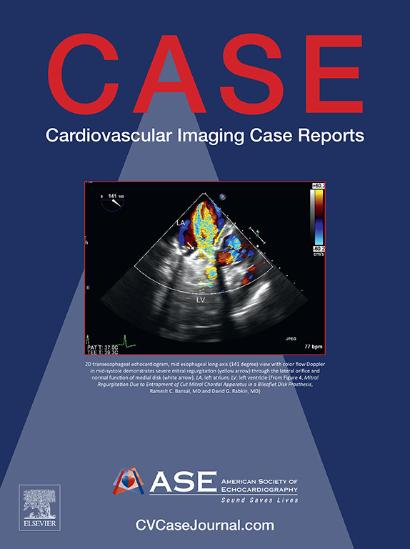 Our March 2024 @CASEfromASE is now online! bit.ly/3EZ3nlI This issue features: 🫀Transseptal Mitral Valve-in-Valve-in-Valve 🫀Biventricular Endomyocardial Fibrosis in a Patient With Chronic Myeloid Leukemia 🫀Severe Pulmonary Hypertension and Pulmonary Thrombi in a Dog