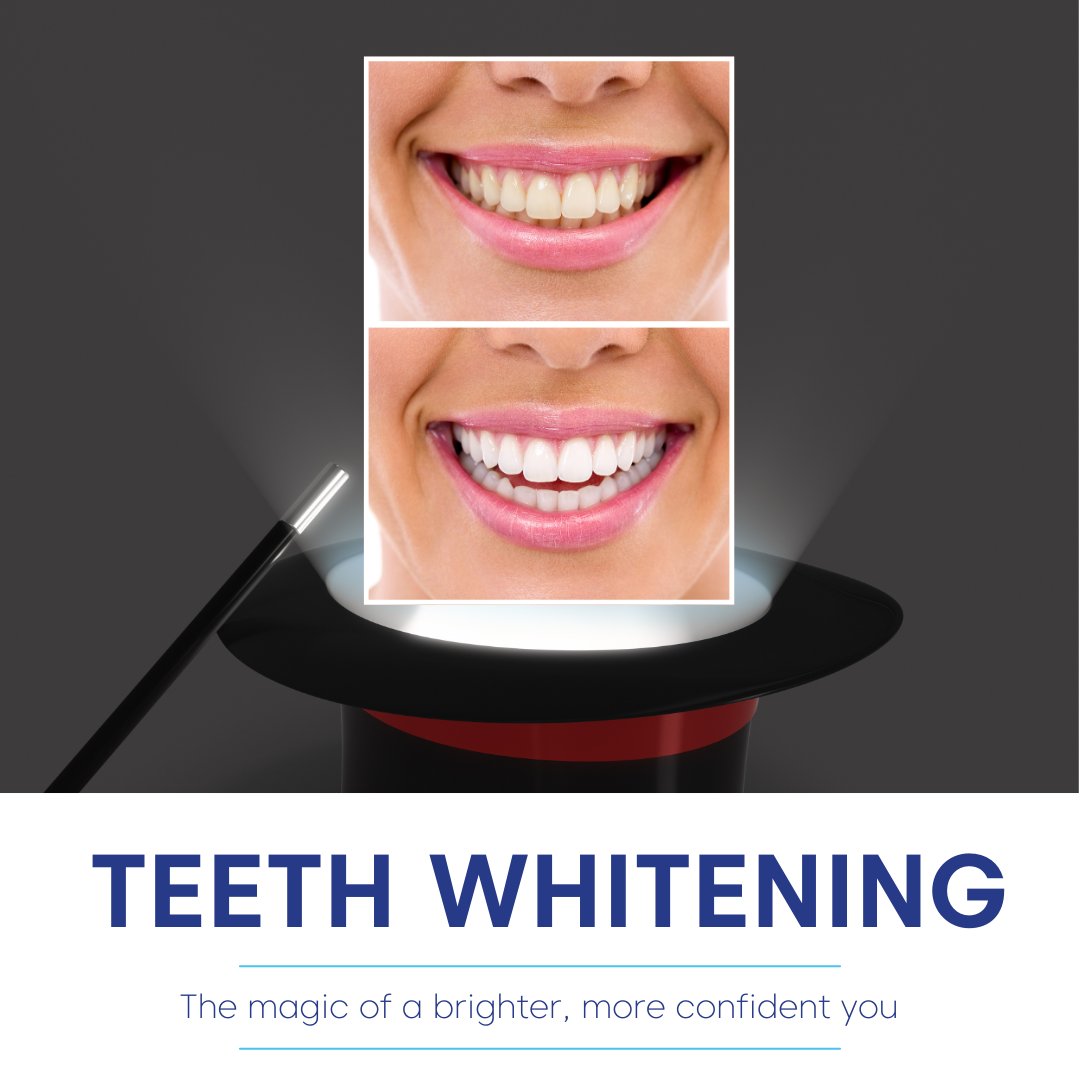 OrthoExperts's tweet image. Embrace the magic of a brighter, more confident you!

You can choose from our professional whitening services in-office, or take home products.

Schedule your smile magic today and let your inner radiance shine!
#SmileMagic #ConfidenceBoost #TeethWhitening✨