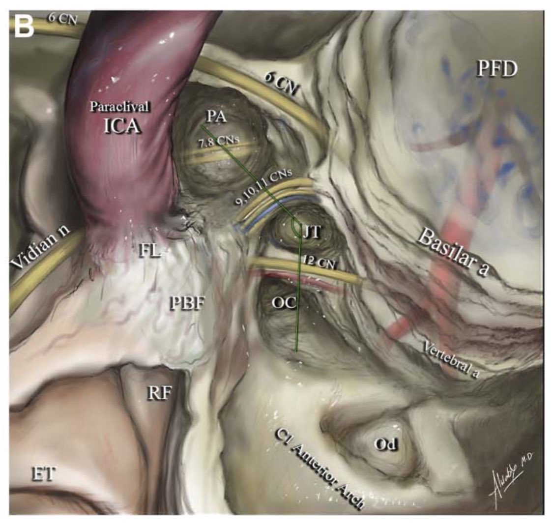 د.محمد الوابلي MD (@malwabili) on Twitter photo الحمدلله على فضله ✨
نشرنا اليوم ورقة علمية في <a href="/NeurosurgeryCNS/">Neurosurgery Publications</a> المرموقة عن مقترح لتكنيك جراحي جديد في جراحات قاع الجمجمة وساهمت بشكل إضافي برسم هذا التكنيك وتفاصيله التشريحية الدقيقة
journals.lww.com/onsonline/abst… الحمدلله على فضله ✨
نشرنا اليوم ورقة علمية في <a href="/NeurosurgeryCNS/">Neurosurgery Publications</a> المرموقة عن مقترح لتكنيك جراحي جديد في جراحات قاع الجمجمة وساهمت بشكل إضافي برسم هذا التكنيك وتفاصيله التشريحية الدقيقة
journals.lww.com/onsonline/abst…