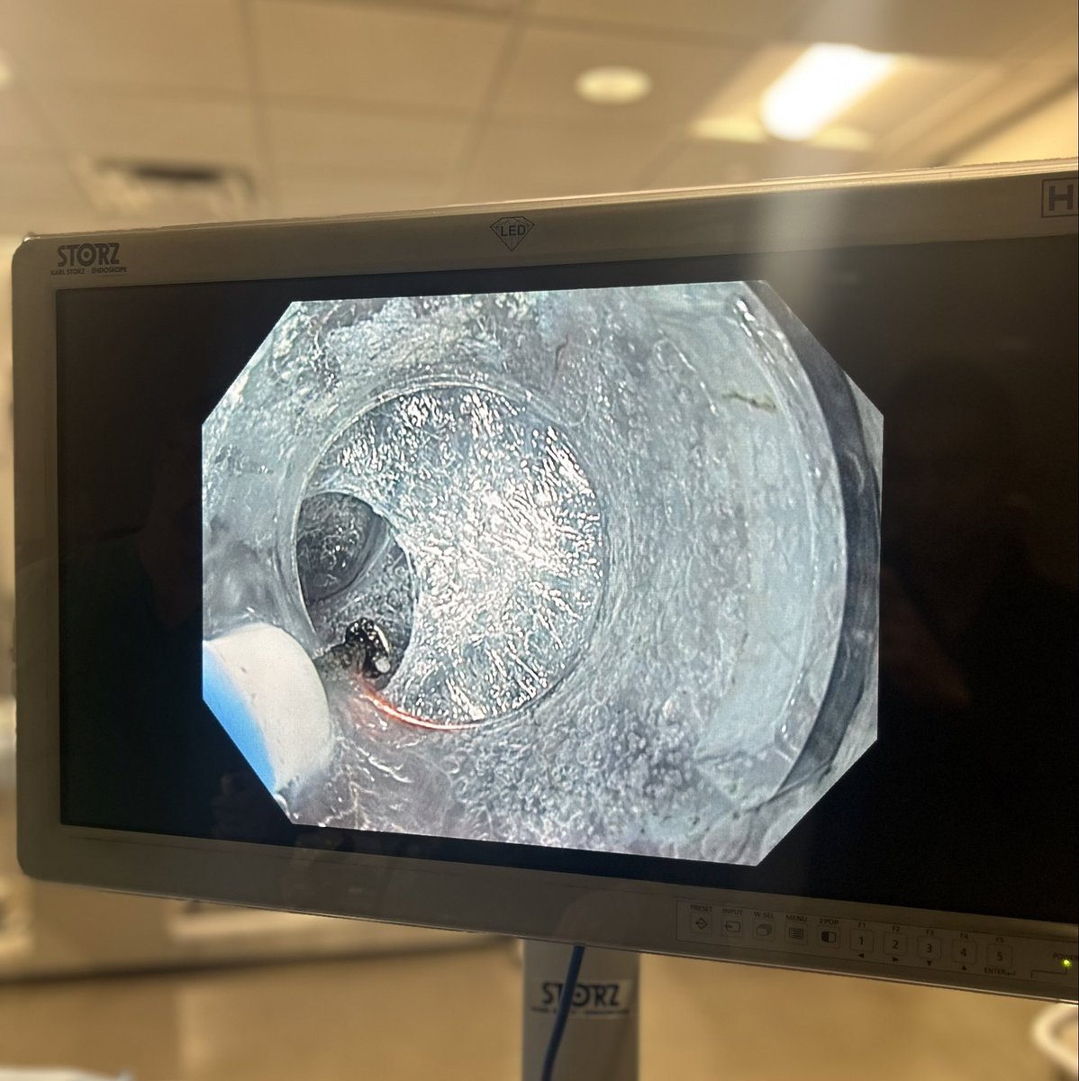 Sunil Amin, MD, FASGE, FRCPC (@sunilaminmd) on Twitter photo Good luck to everyone applying for advanced endoscopy this year‼️
Our current AEF <a href="/NicoleFerranteD/">Nicole Ferrante</a> and I had a wonderful 1:1 session at our 🌴<a href="/UMiamiHealth/">UMiami Health System</a> 🌴animal lab yesterday working on all things #POEM
✅ Mucosal entry
✅ Tunneling
✅ Myotomy
✅ Hemostasis
✅ Closure Good luck to everyone applying for advanced endoscopy this year‼️
Our current AEF <a href="/NicoleFerranteD/">Nicole Ferrante</a> and I had a wonderful 1:1 session at our 🌴<a href="/UMiamiHealth/">UMiami Health System</a> 🌴animal lab yesterday working on all things #POEM
✅ Mucosal entry
✅ Tunneling
✅ Myotomy
✅ Hemostasis
✅ Closure