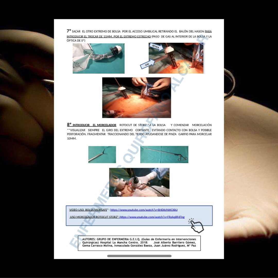 GUÍA DE USO DE BOLSA PARA MORCELACIÓN
DE TEJIDO EN LAPAROSCOPIA MORSAFE®

#EnfermerosQuirófanoAlcázar #GuíasQuirúrgicas 

🔗drive.google.com/file/d/1PdiG99…

<a href="/AeeqSpain/">AEEQ Spain</a> <a href="/charo_79/">Charo Merino</a> <a href="/jjquesadaguzman/">Procedimientos en quirófano. Guía de preparación</a> <a href="/jvfa01/">enfermera_de_quirofano</a>