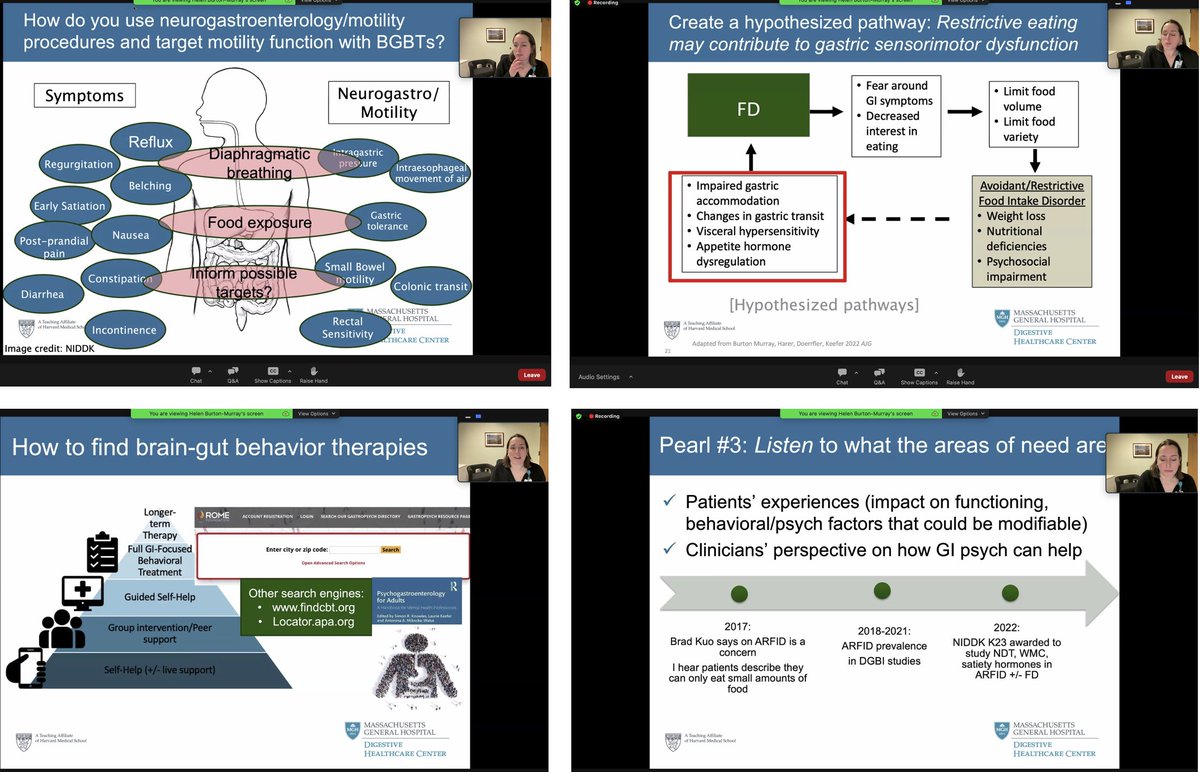 Amazing talk on #BrainGut #Behavioral therapies @DrHBurtonMurray 👏 #DGBIs ✳️Pearls of Wisdom on Utilization for Using Neurogastroenterology and Motility Procedures for Developing a GI Psychology Clinical Management Plan🔥 🎯Talking with patients about how a #BGBT may improve