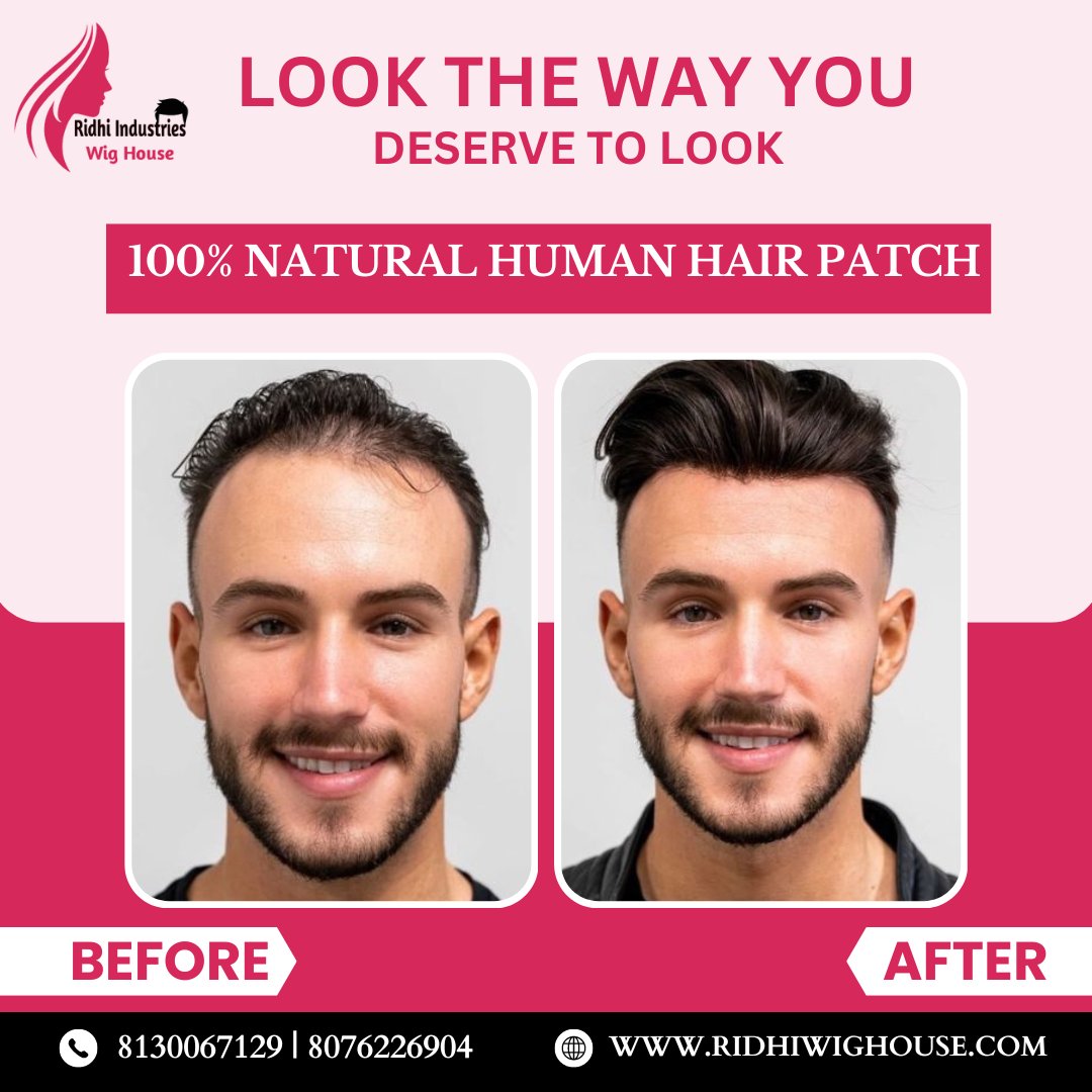 Best Hair Replacement Products At Wholesale Price: These are customized Hair Patches, Hair Wigs, and Hair toppers that are made to match your hair color, texture, and density. 
#NonSurgicalHairReplacement #HairReplacementProducts #HumanHairPatch #NaturalHairWigs #HairLossSolution
