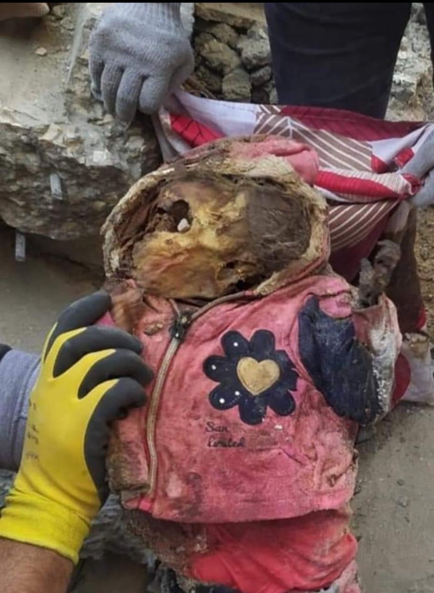 InsiderWorld_1's tweet photo. Joud Shomer, 147 days under the rubble. https://t.co/VqAEH15xxQ