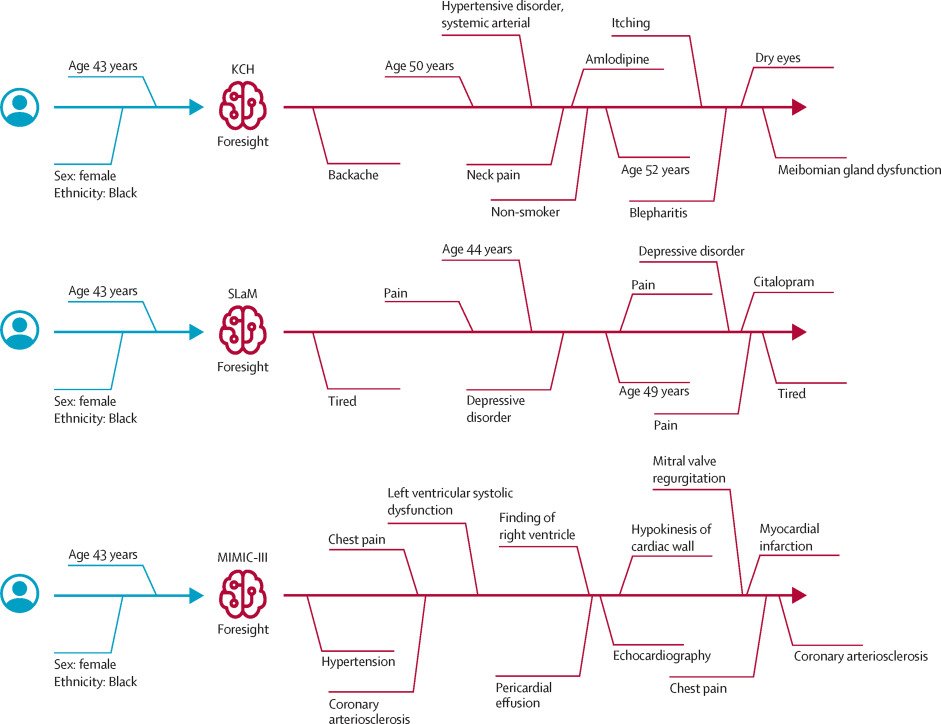 Using @cogstack deep phenotyping AI means any hospital can produce such large scale data for #GenAI In fact, there isn't one Foresight model; we made one from each #NHS hospital using >10 years of data! @KingsCollegeNHS @MaudsleyNHS @KingsCollegeLon @KingsIoPPN @GSTTnhs /3