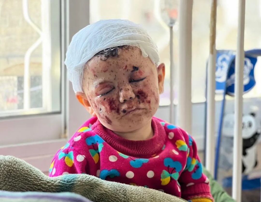 Filistin özgür olsun çocuklar ölmesin! 
#FreePalesine