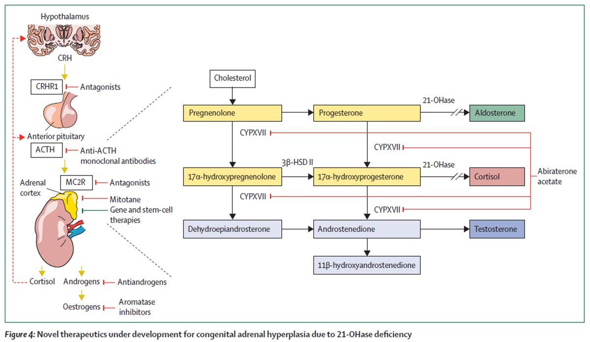 Hiperplasia suprarrenal Síntesis hormonal Síntomas mineralocorticoides glucocorticoides adrenales Fenotipos: virilizante / perdedor de sal; clásico/no clásico Tx: hidrocortisona, fludrocortisona, sal DOI: 10.1016/S0140-6736(22)01330-7 @DiarioDeMedico #pediatria