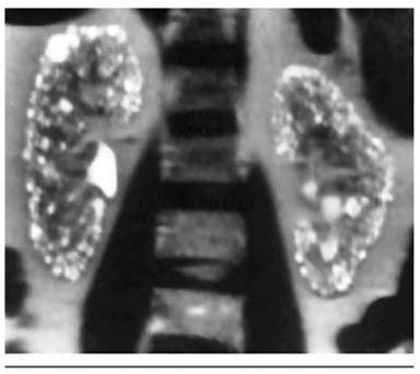 What psychiatric diagnosis does this patient have? Cause? Classic case. Source: Radiology