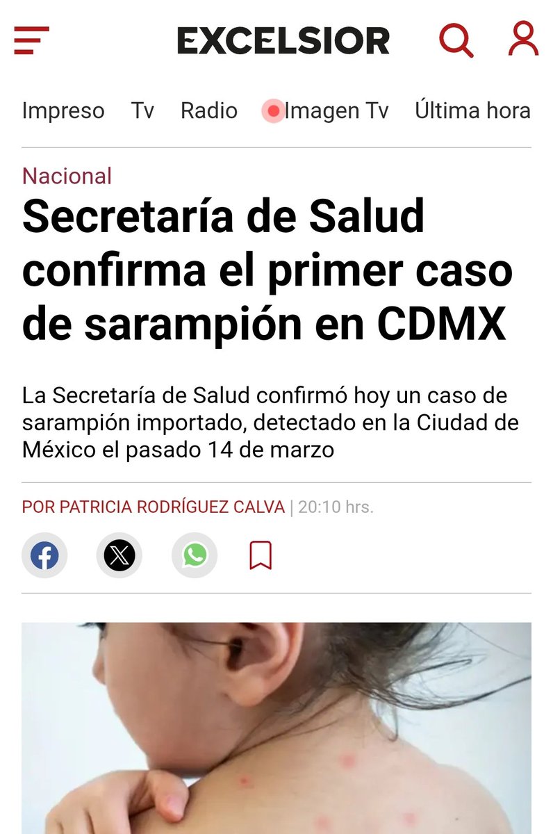 Esto es el resultado de la negligencia, de la apatía y del total descuido en la vacunación infantil.
Esto sucede en la ciudad donde la ex jefa de gobierno <a href="/Claudiashein/">Claudia Sheinbaum Pardo</a> dice que todo esta bien.
Una científica que descuidó la salud de los niños.