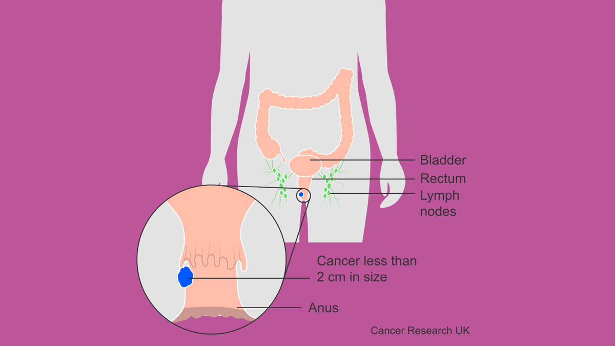 Hey Tutti! 

It's Cancer Awareness Thursday, and today we're focusing on something important: #analcancer. 

Let's learn about what it is, the stats, and how we can prevent it. 

#CancerAwarenessThursday #AnalCancerAwareness