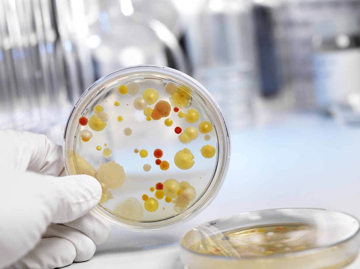 International Lipidomics Society (@___ils____) on Twitter photo Interest group Microbial Lipids @ ILS. New frontiers and lipids! We are proceeding with an exciting program; stay tuned to learn what's next.
@AvantiLipids <a href="/EpiLipidNET/">EpiLipidNET</a> <a href="/lipidmaps/">LIPID MAPS</a> <a href="/LabShevchenko/">Shevchenko Lab</a> <a href="/LipidomicsSI/">Lipidomics Standard Initiative (LSI)</a> Interest group Microbial Lipids @ ILS. New frontiers and lipids! We are proceeding with an exciting program; stay tuned to learn what's next.
@AvantiLipids <a href="/EpiLipidNET/">EpiLipidNET</a> <a href="/lipidmaps/">LIPID MAPS</a> <a href="/LabShevchenko/">Shevchenko Lab</a> <a href="/LipidomicsSI/">Lipidomics Standard Initiative (LSI)</a>