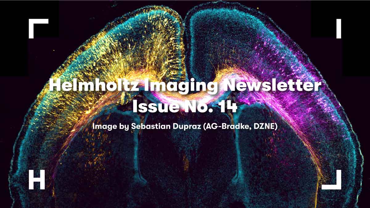 🎉 Our most recent edition of our #HelmholtzImaging newsletter is out! Highlights include: 🔹#HIConference2024: Submit your abstract by 27/3 🔹Enhanced #CONNECT & #HISupportHub 🔹New open-source tools: Open-ST & Polarity-JaM 🔹& more Happy reading 👉 bit.ly/HI-Newsletter-…