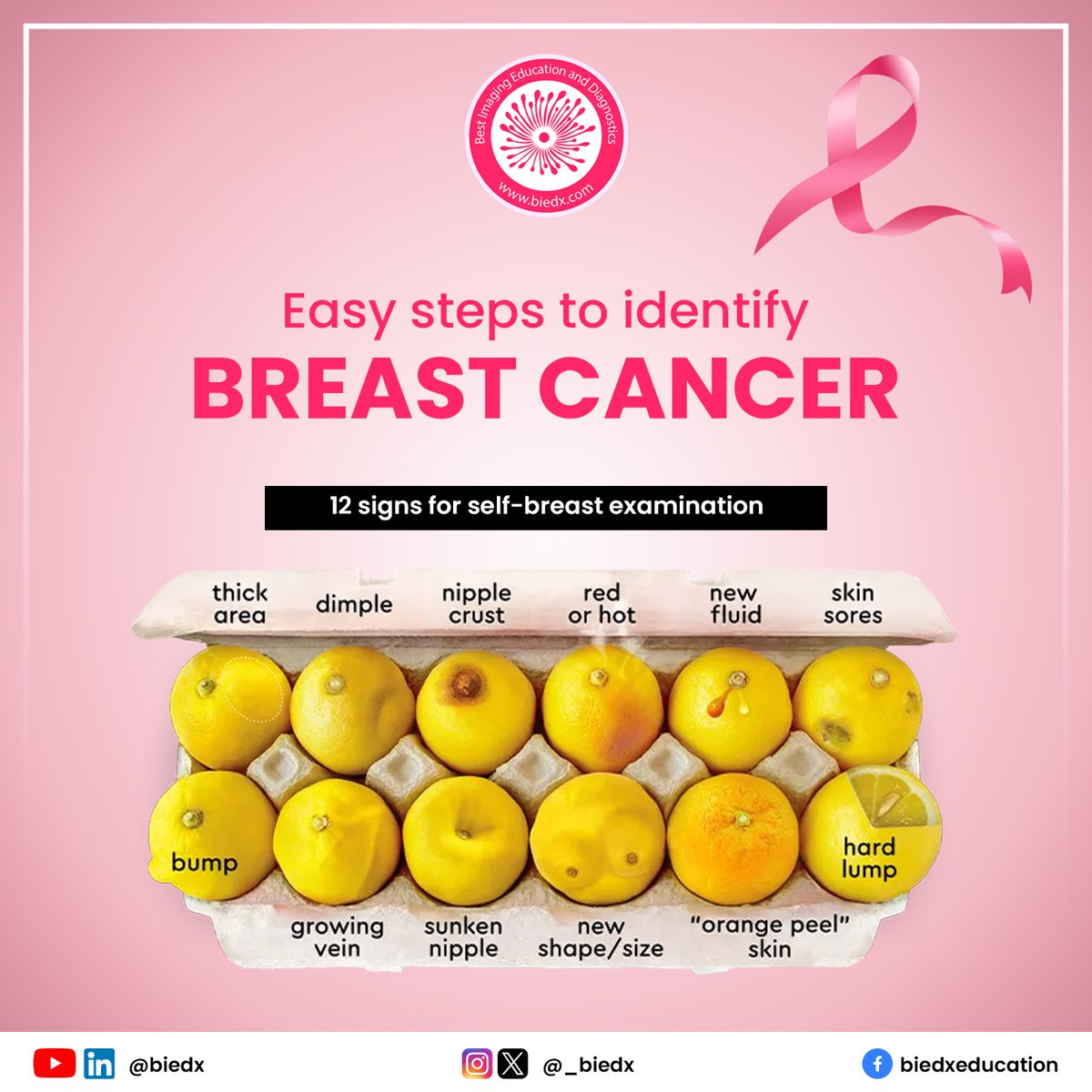 'Early detection is key. Spot the signs of breast cancer with these simple steps. Your health is in your hands!'

Share with your women to show you care!

#BreastImaging #Mammography #AI #BreastMRI #MRI #RadiologyEducation #MedicalCourses #ImagingTraining #HealthcareLearning