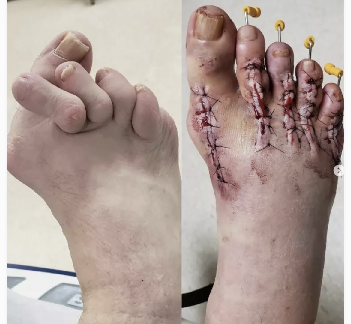 blair_kizza's tweet photo. Art of Surgery at its best ✊🏽 https://t.co/YCZMOEpfbn
