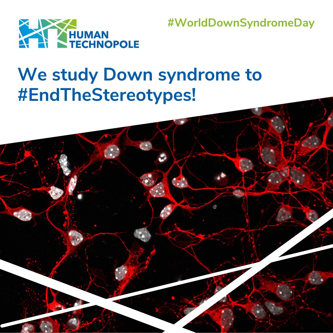 👐 Today is #WorldDownSyndromeDay, a global call to #EndTheStereotypes! 🔬 In our labs, @emanuele_capra (@KalebicNereo Group) uses various biological models, including neuronal cultures, to study molecular and cellular features of Down syndrome [Grey, nuclei; Red, bIII Tubulin]