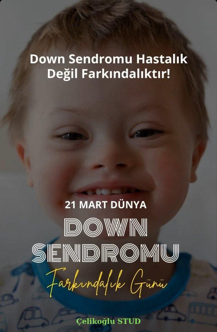 Dön Sendromu Hastalık Değil Farkındalıktır...

#DownSendromuFarkindalikGunu 
#21Martdownsendromufarkindalikgunu