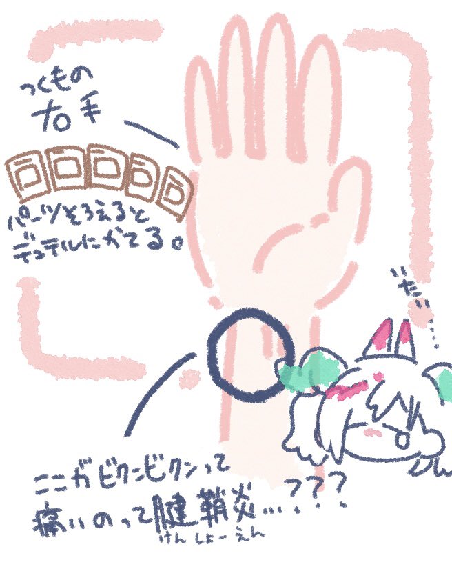 腱鞘炎になった事ないんですけど、腱鞘炎ってどこが痛くなったら腱鞘炎ですか…?
右も左もここがビクンビクンしてて痛くて泣いてる 