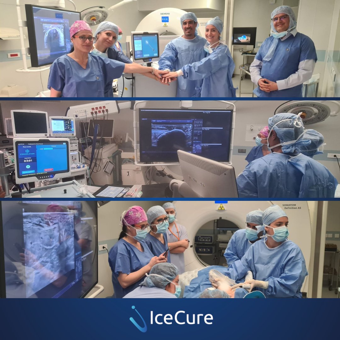 We love seeing teamwork in the effort of making #cryoablation accessible around the world. Dr. Toulsie Ramtohul & Dr. Ariane Panafieu of @institut_curie, France, hosted Dr. Georgiana Camen & Dr. Serenella Sipos from Romania for 2 #ProSense #BreastCancer #cryoablation procedures.