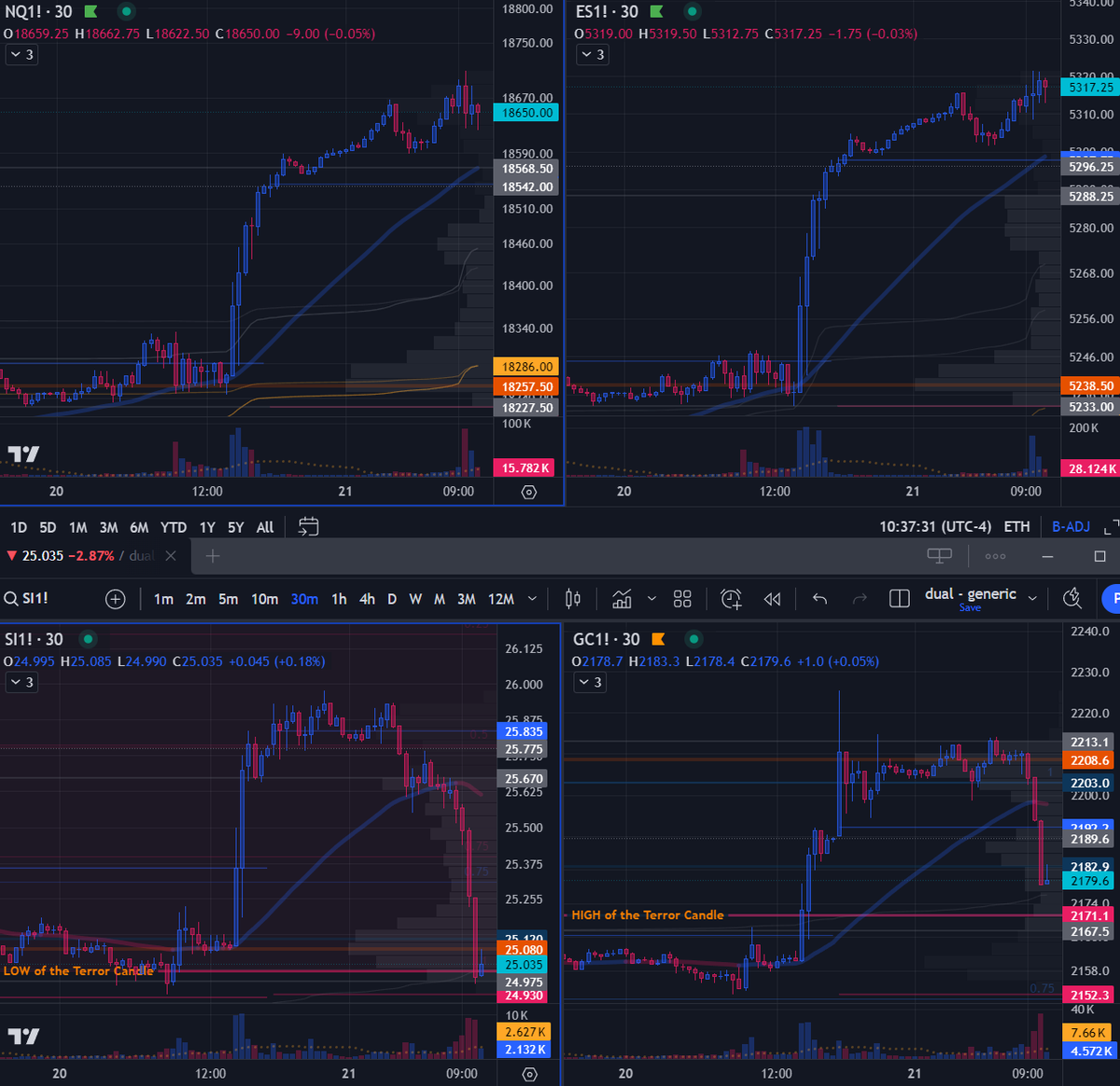 GoldGrumpGranpa's tweet photo. Now that metals are attempting to try a little bounce, a typical strategy is to hit hard #NQ and #ES to trigger a micro-liquidity event just as the two poor metallic bastard are struggling to surface.
Let's see if this pattern holds true this time as well.
#SilverSqueeze #PreciousMetals #Inflation #MarketManipulation #Gold #Silver #RealMoney #XAGUSD #XAUUSD #XAUEUR #XAGEUR #DXY #Dollar #Gold2000 #MrSlammy #UnemploymentClaims #FlashPMI