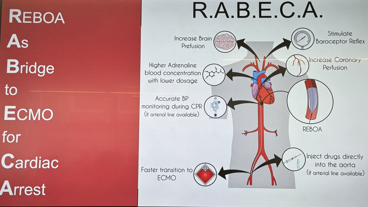 RABECA #REBOA as bridge to #ECMO in cardiac arrest
🧠 to increase brain prefusion
🫀 to increase coronary prefusion
💉 to achieve higher adrenaline blood concentration with lower dosage
🩸to provide accurate BP monitoring during CPR (if arterial line available)
🩸to stimulate
