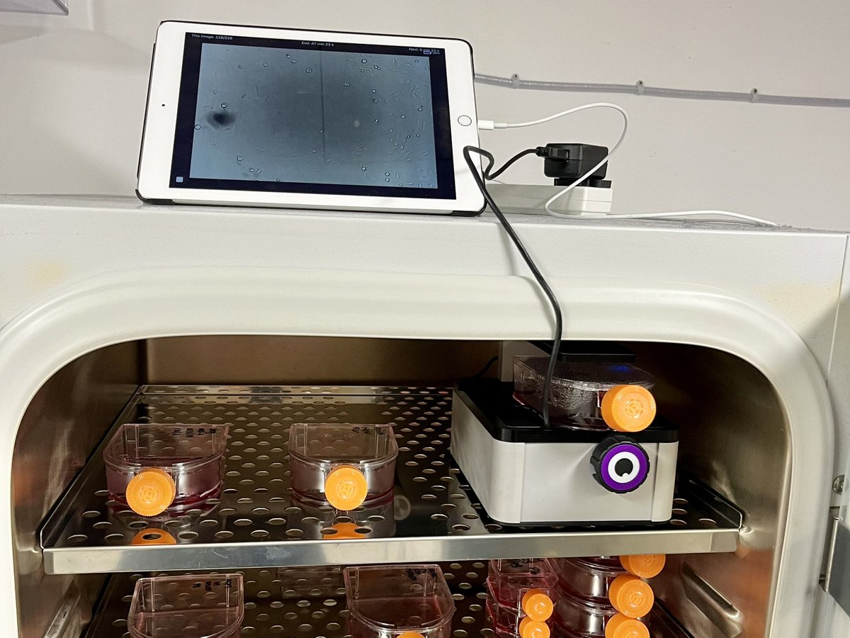 ioLight Magnificent Mobile Microscopes (@iolightmicro) on Twitter photo Great to see the ioLight Cell Imager doing #livecellimaging of cancer cells from inside an incubator at <a href="/BiologyatYork/">Biology at York</a>. Thanks to @WJBrackenbury for testing the #microscope. #cellimaging Great to see the ioLight Cell Imager doing #livecellimaging of cancer cells from inside an incubator at <a href="/BiologyatYork/">Biology at York</a>. Thanks to @WJBrackenbury for testing the #microscope. #cellimaging